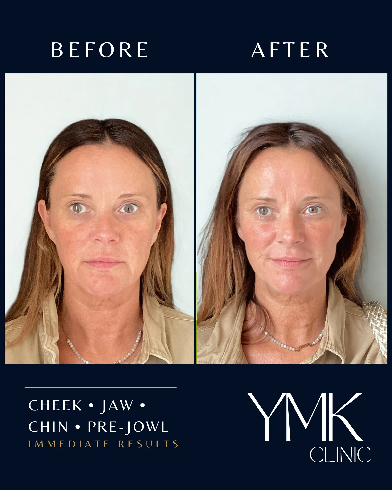 Before and after photographs, case 001.