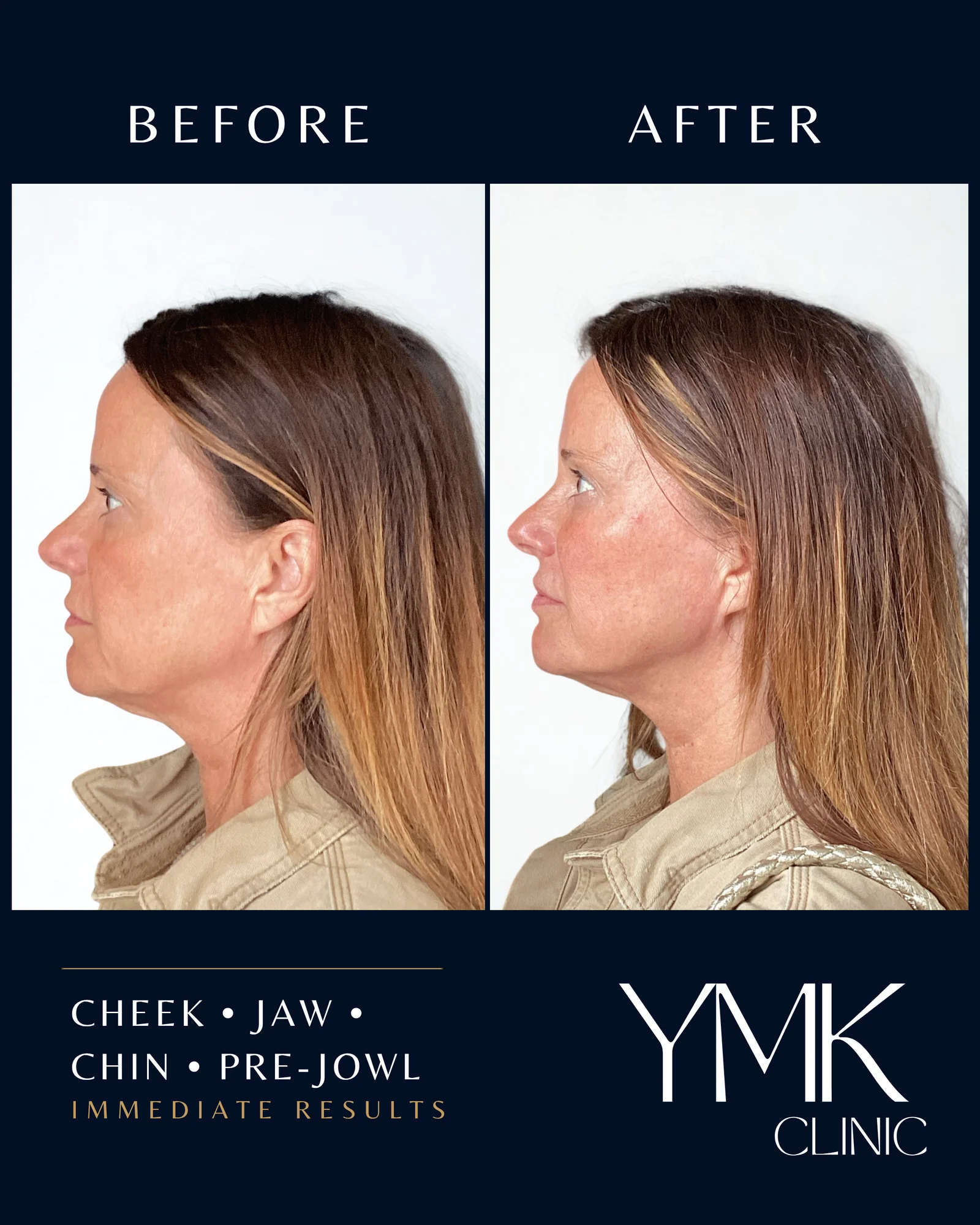 Before and after photographs, case 001.