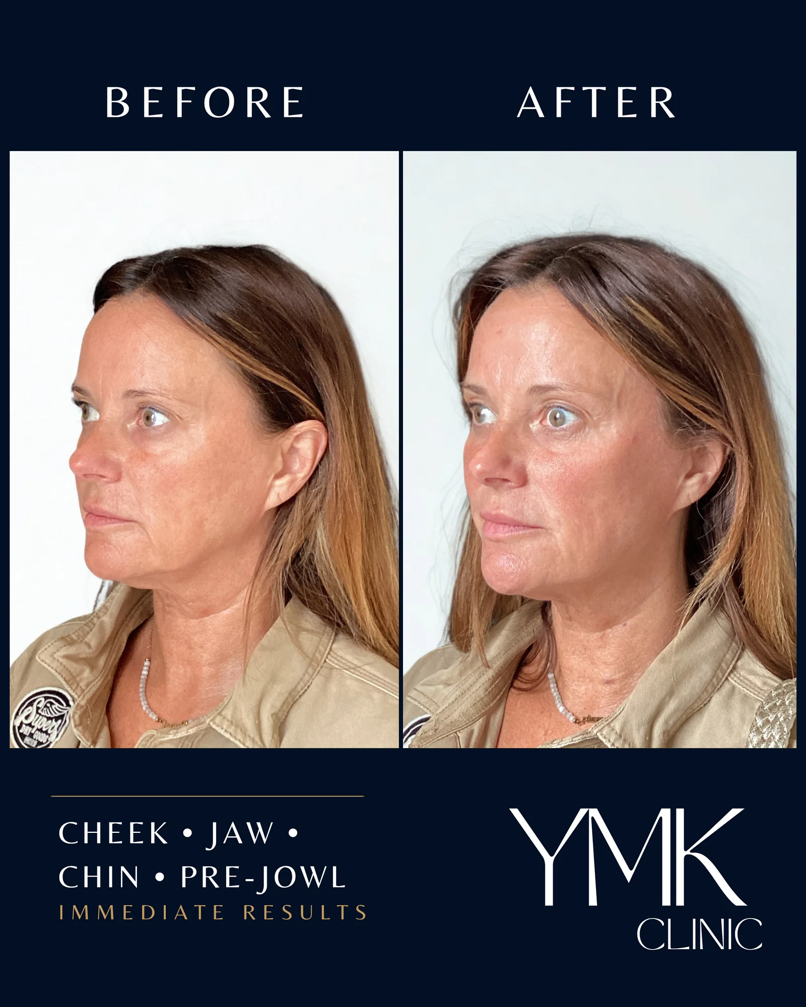 Before and after photographs, case 001.