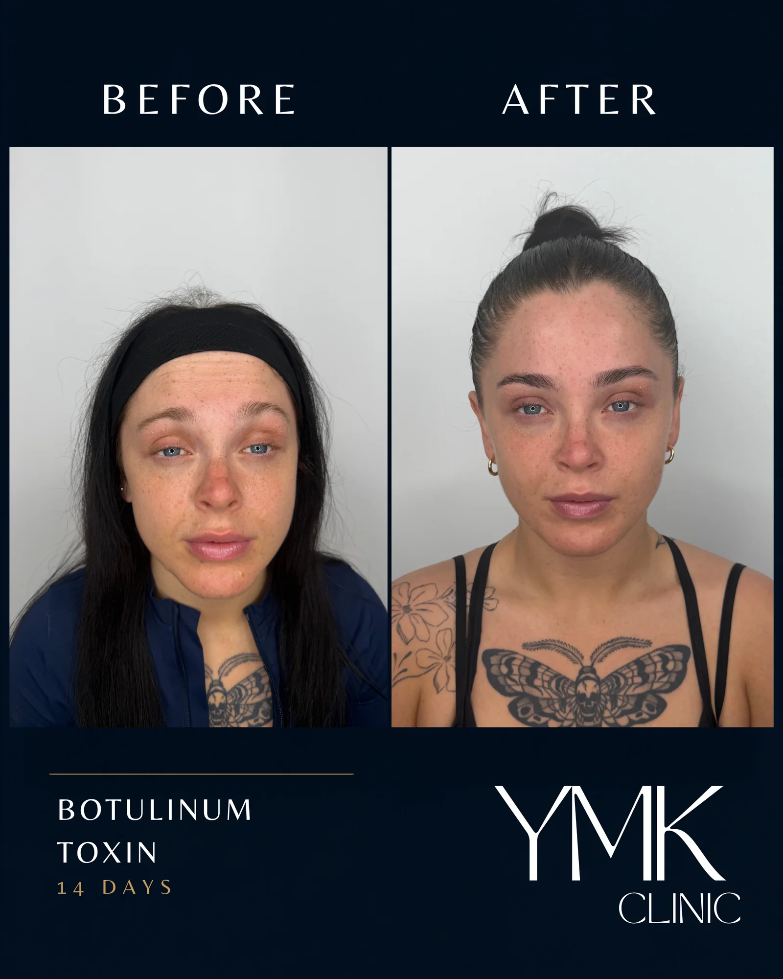 Before and after photographs, case 003.