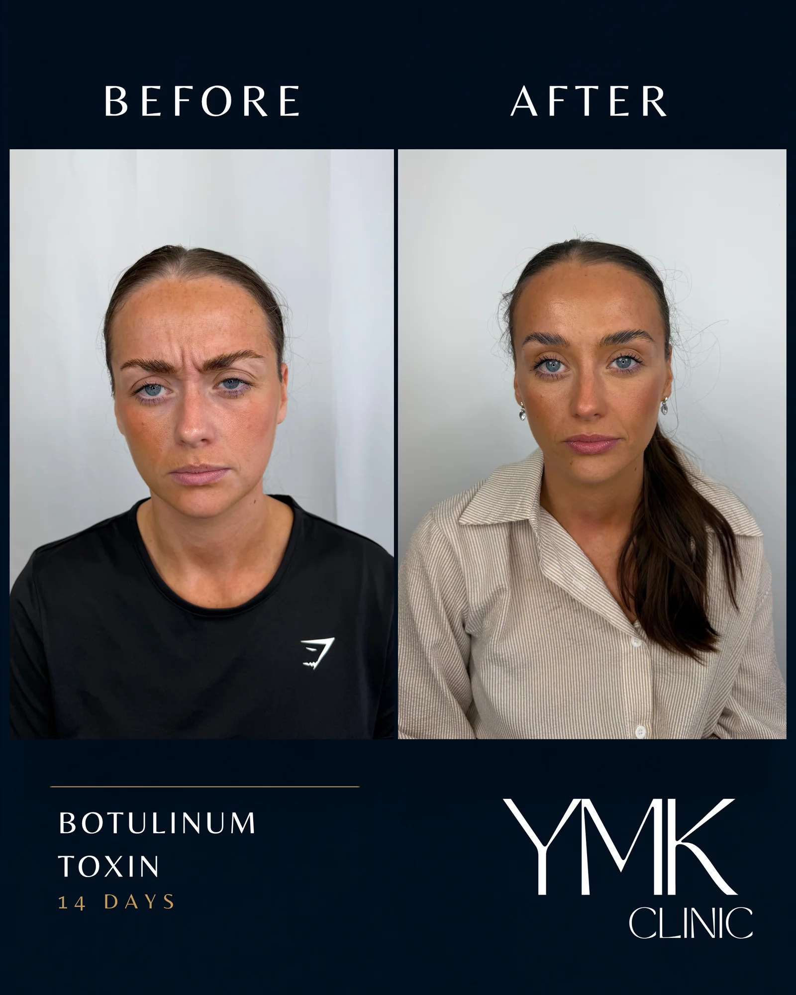 Before and after photographs, case 004.