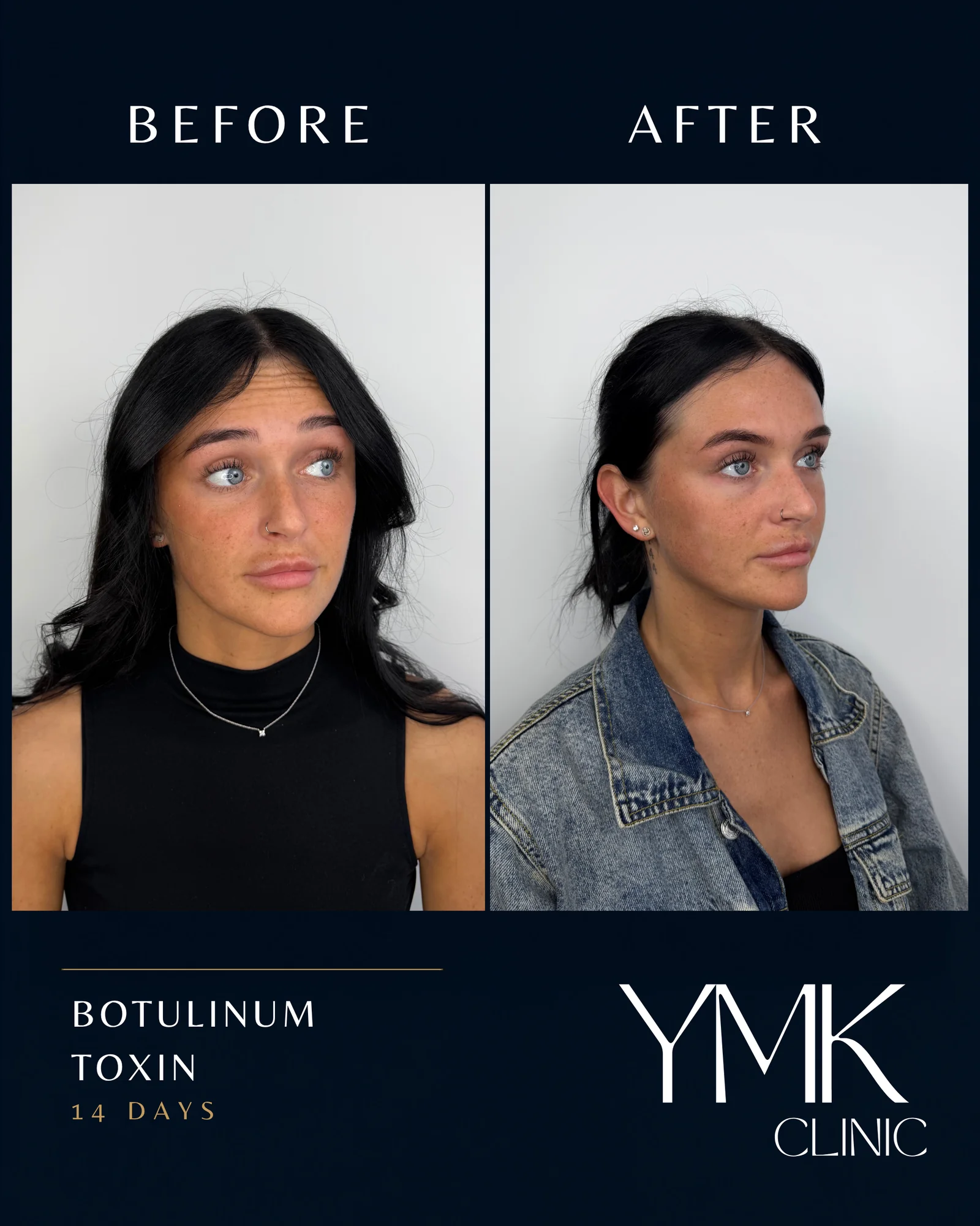 Before and after photographs, case 005.